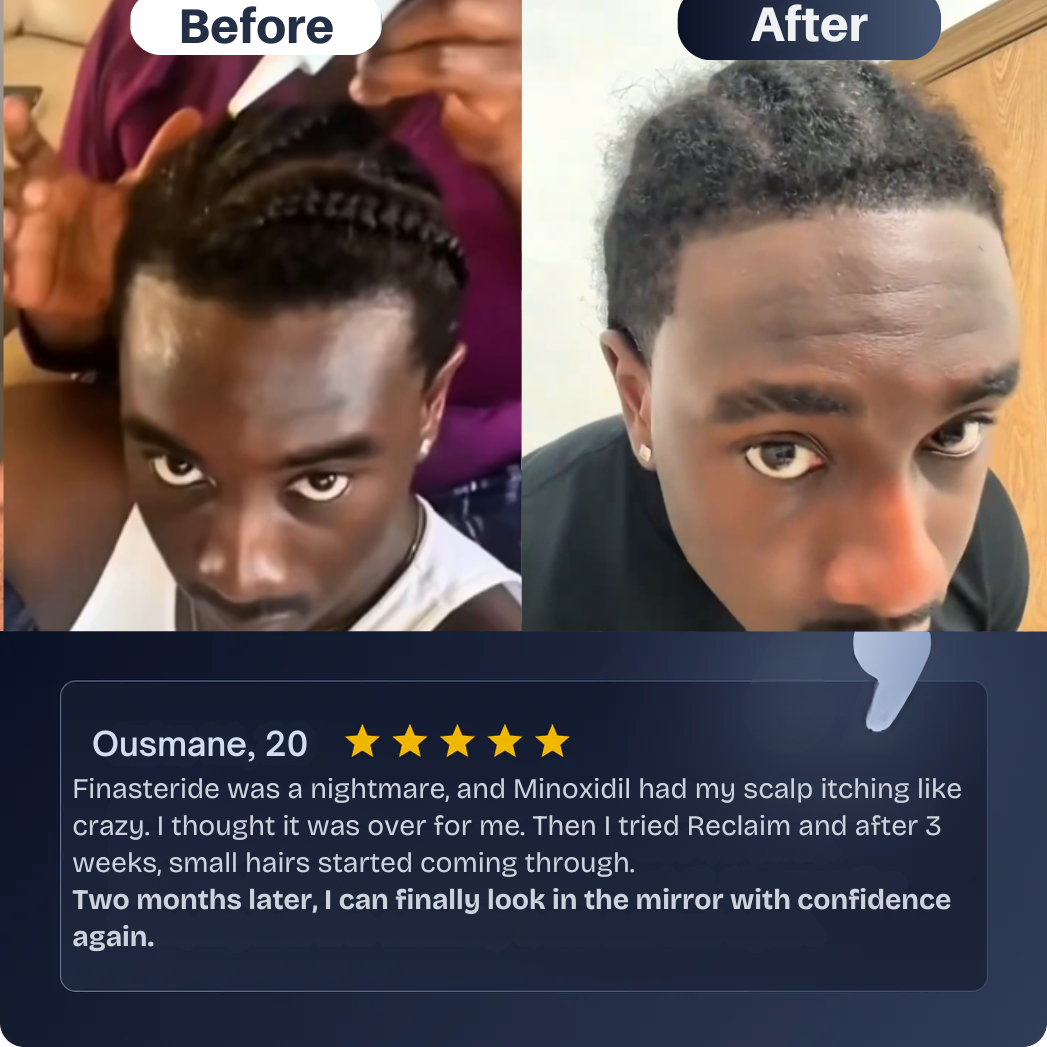 Reclaim - Hair Regrowth Serum